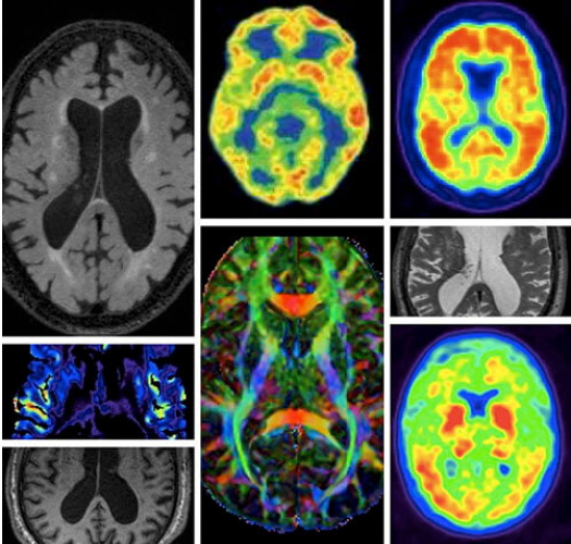 different brain scan images